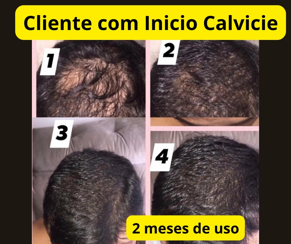 Resultado Barbudom